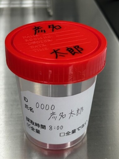 採取容器の側面にシールを貼った記入例