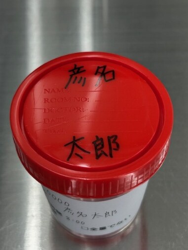 採取容器の蓋へ名前を記入した例